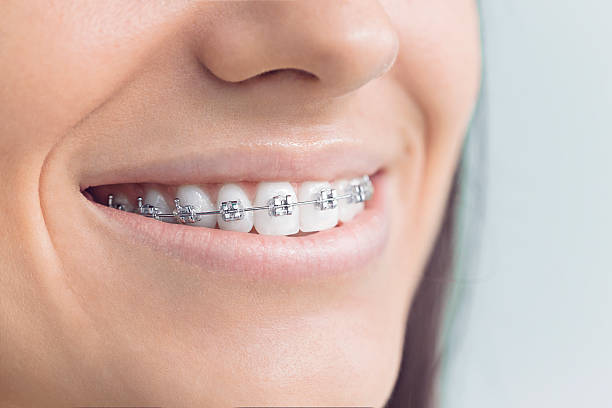 Best Full Mouth Reconstruction  in Buckhead, GA